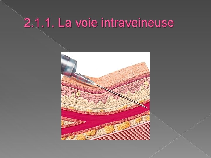 2. 1. 1. La voie intraveineuse 2. 1. 1. La voie intraveineuse