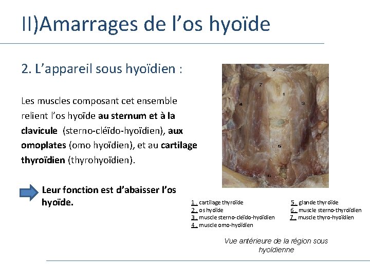 II)Amarrages de l’os hyoïde 2. L’appareil sous hyoïdien : Les muscles composant cet ensemble