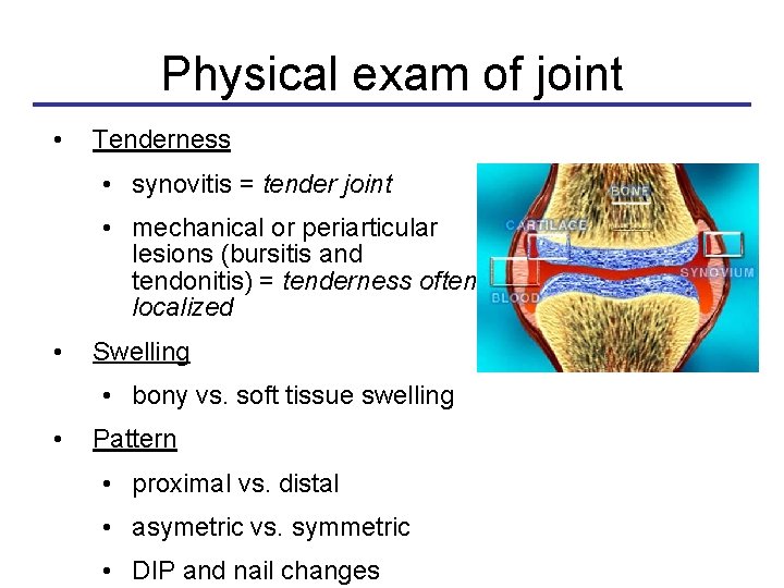 Physical exam of joint • Tenderness • synovitis = tender joint • mechanical or