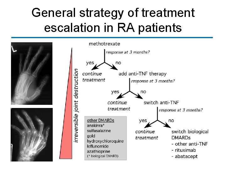 General strategy of treatment escalation in RA patients 