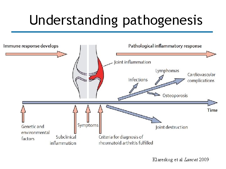 Understanding pathogenesis Klareskog et al Lancet 2009 