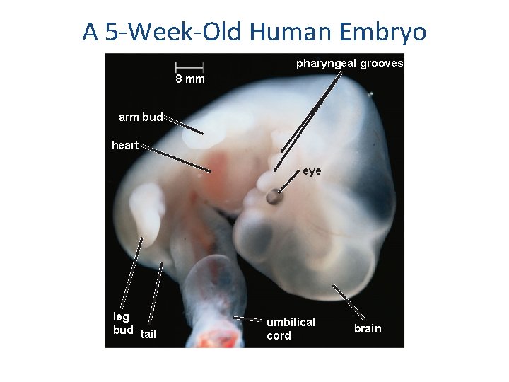 A 5 -Week-Old Human Embryo pharyngeal grooves 8 mm arm bud heart eye leg
