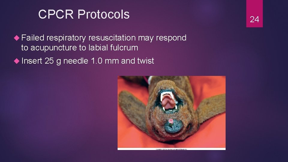 CPCR Protocols Failed respiratory resuscitation may respond to acupuncture to labial fulcrum Insert 25 CPCR Protocols Failed respiratory resuscitation may respond to acupuncture to labial fulcrum Insert 25
