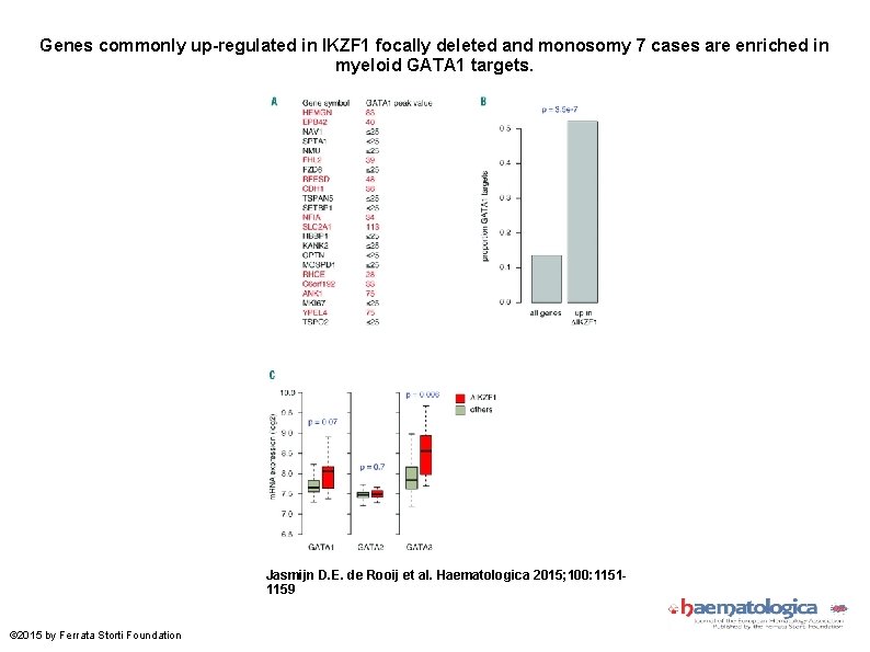 Genes commonly up-regulated in IKZF 1 focally deleted and monosomy 7 cases are enriched Genes commonly up-regulated in IKZF 1 focally deleted and monosomy 7 cases are enriched