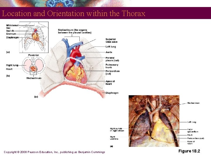 Location and Orientation within the Thorax Copyright © 2008 Pearson Education, Inc. , publishing