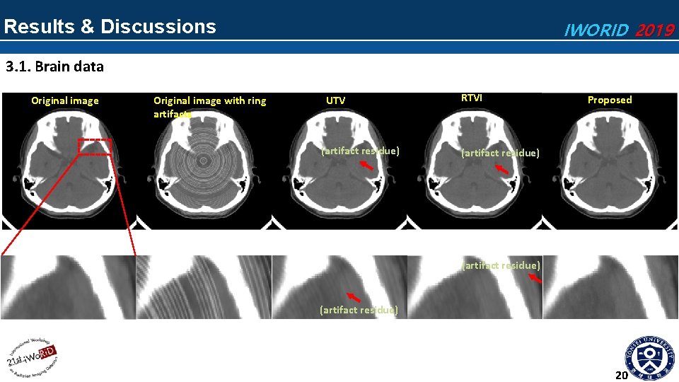 Results & Discussions IWORID 2019 3. 1. Brain data Original image with ring artifacts