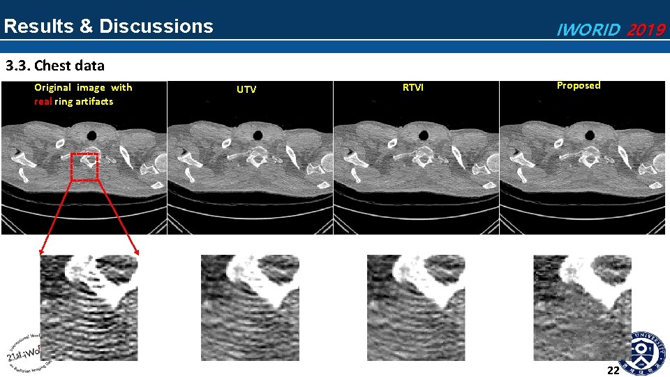 Results & Discussions IWORID 2019 3. 3. Chest data Original image with real ring