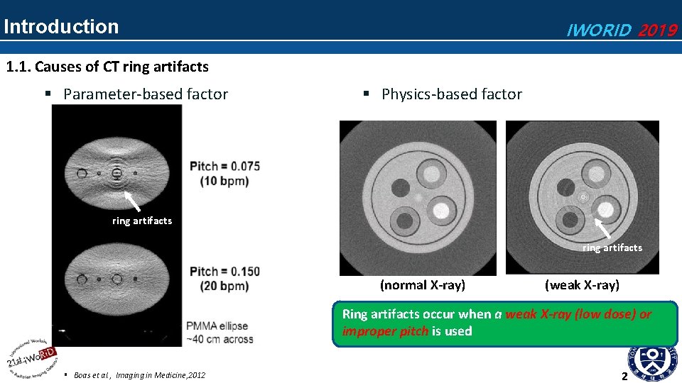 Introduction IWORID 2019 1. 1. Causes of CT ring artifacts § Parameter-based factor § Introduction IWORID 2019 1. 1. Causes of CT ring artifacts § Parameter-based factor §