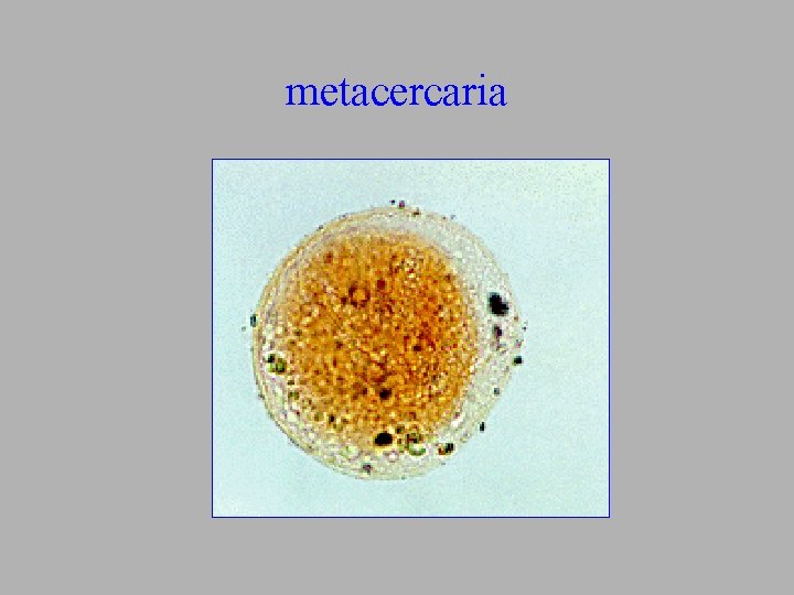 metacercaria 