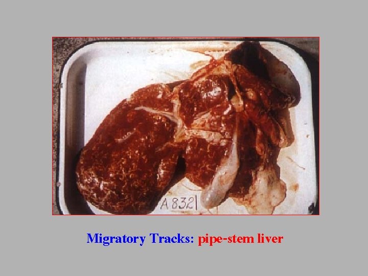 Migratory Tracks: pipe-stem liver 
