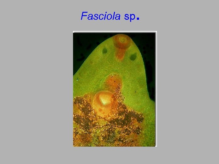 Fasciola sp. 