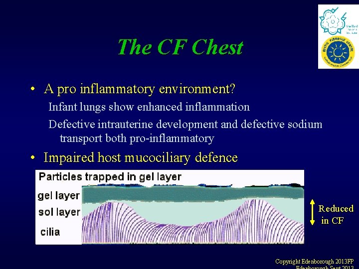 The CF Chest • A pro inflammatory environment? Infant lungs show enhanced inflammation Defective The CF Chest • A pro inflammatory environment? Infant lungs show enhanced inflammation Defective