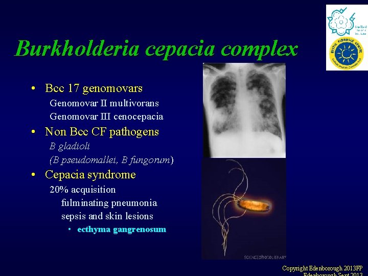 Burkholderia cepacia complex • Bcc 17 genomovars Genomovar II multivorans Genomovar III cenocepacia • Burkholderia cepacia complex • Bcc 17 genomovars Genomovar II multivorans Genomovar III cenocepacia •