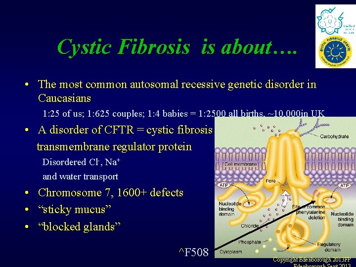 Cystic Fibrosis is about…. • The most common autosomal recessive genetic disorder in Caucasians Cystic Fibrosis is about…. • The most common autosomal recessive genetic disorder in Caucasians