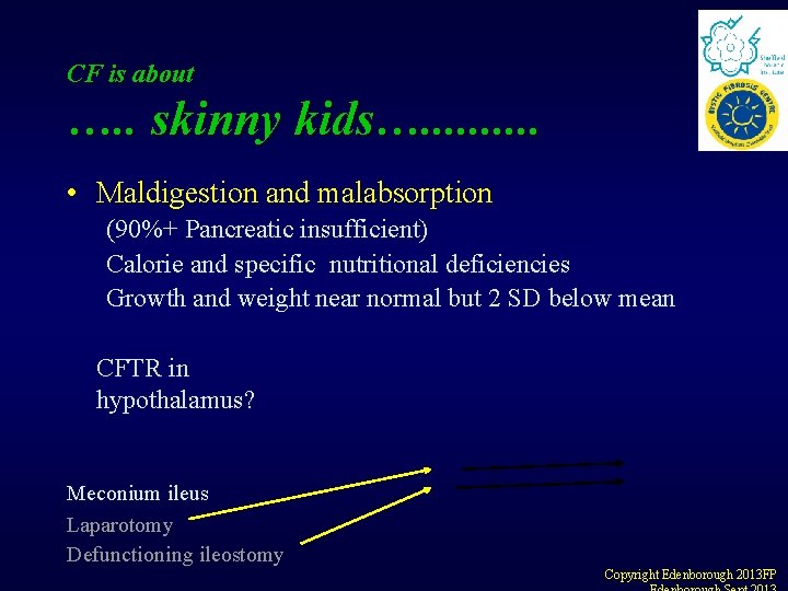 CF is about …. . skinny kids…. . • Maldigestion and malabsorption (90%+ Pancreatic CF is about …. . skinny kids…. . • Maldigestion and malabsorption (90%+ Pancreatic