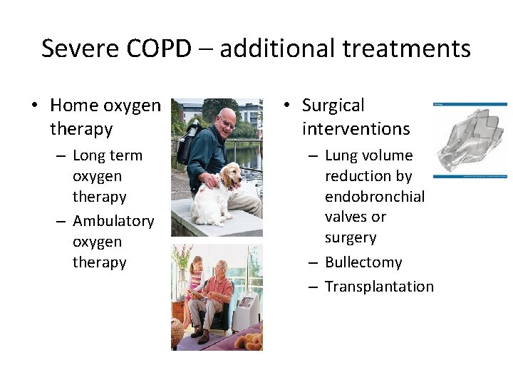 Severe COPD – additional treatments • Home oxygen therapy – Long term oxygen therapy Severe COPD – additional treatments • Home oxygen therapy – Long term oxygen therapy