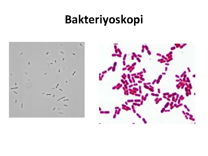 Bakteriyoskopi 