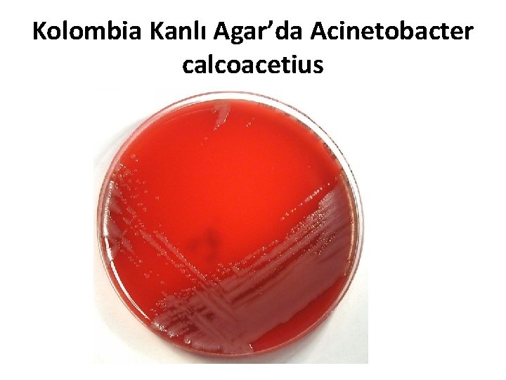 Kolombia Kanlı Agar’da Acinetobacter calcoacetius 