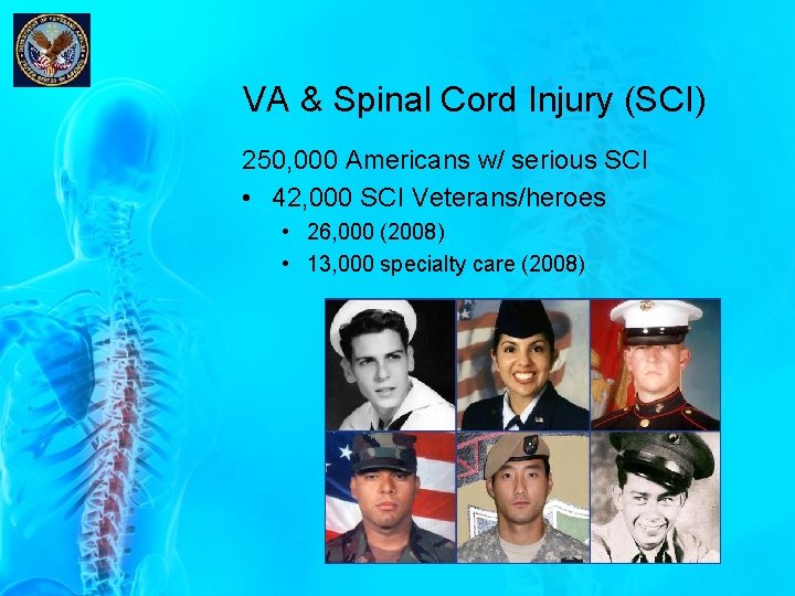 VA & Spinal Cord Injury (SCI) 250, 000 Americans w/ serious SCI • 42, VA & Spinal Cord Injury (SCI) 250, 000 Americans w/ serious SCI • 42,
