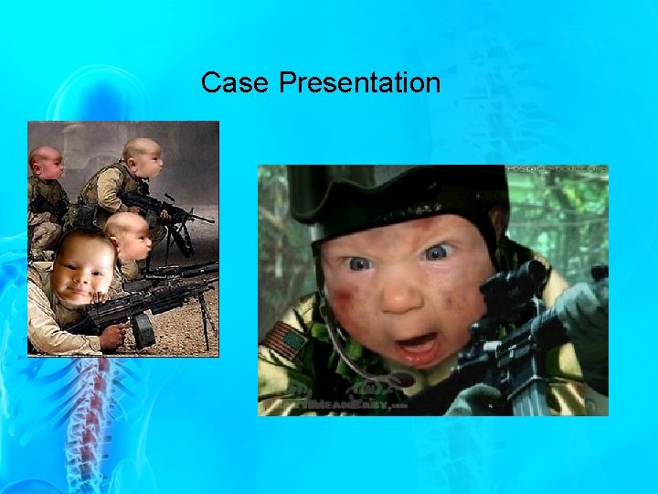 Case Presentation Case Presentation