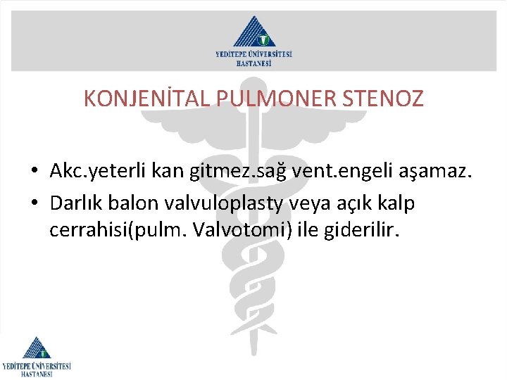 KONJENİTAL PULMONER STENOZ • Akc. yeterli kan gitmez. sağ vent. engeli aşamaz. • Darlık