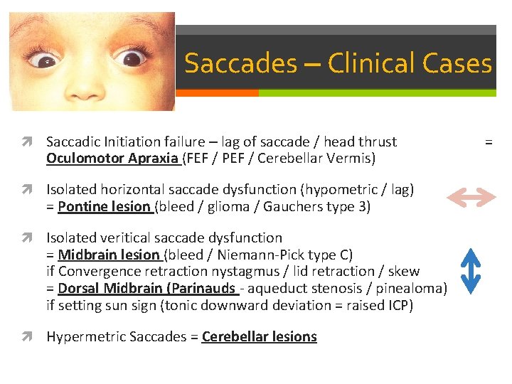 Saccades – Clinical Cases Saccadic Initiation failure – lag of saccade / head thrust