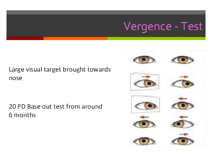 Vergence - Test Large visual target brought towards nose 20 PD Base out test