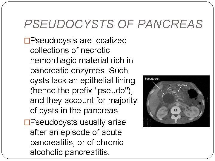 PSEUDOCYSTS OF PANCREAS �Pseudocysts are localized collections of necrotichemorrhagic material rich in pancreatic enzymes.