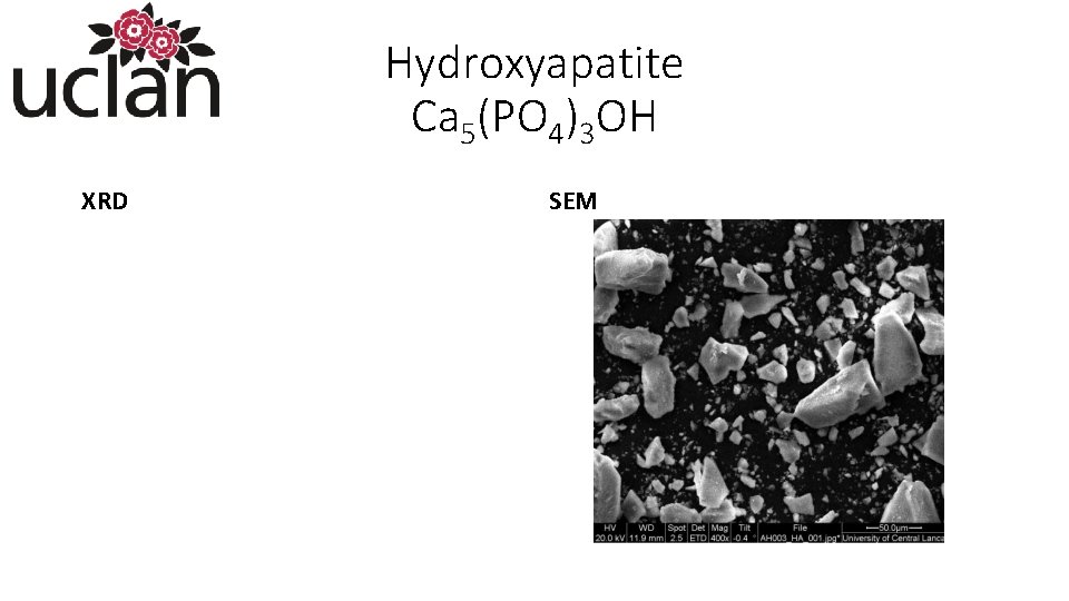 Hydroxyapatite Ca 5(PO 4)3 OH XRD SEM 
