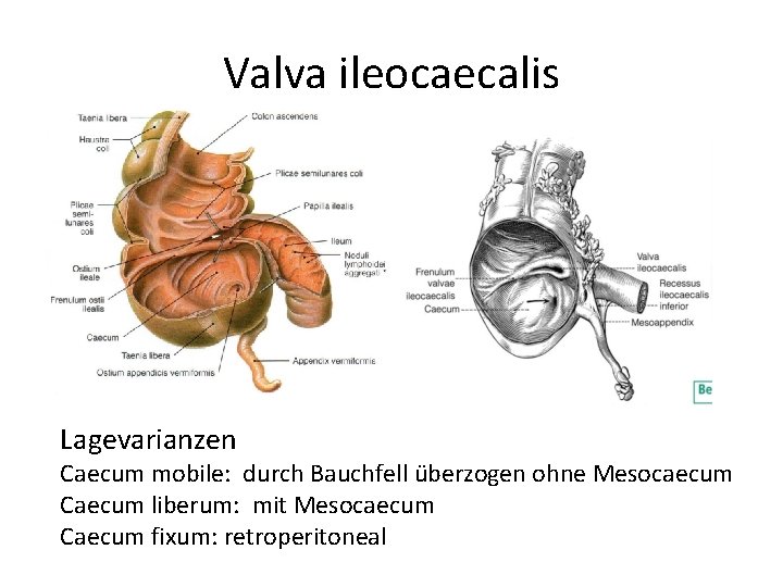 Valva ileocaecalis Lagevarianzen Caecum mobile: durch Bauchfell überzogen ohne Mesocaecum Caecum liberum: mit Mesocaecum