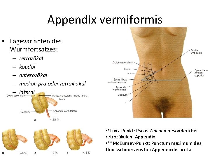 Appendix vermiformis • Lagevarianten des Wurmfortsatzes: – – – retrozäkal kaudal anterozäkal medial: prä-oder