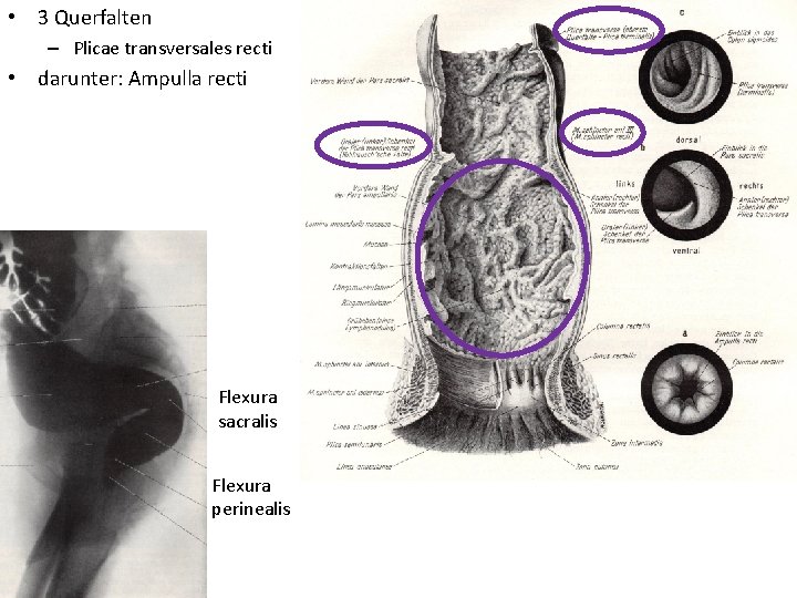  • 3 Querfalten – Plicae transversales recti • darunter: Ampulla recti Flexura sacralis