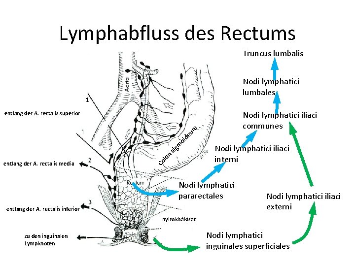 Lymphabfluss des Rectums Truncus lumbalis Nodi lymphatici lumbales 1 Nodi lymphatici iliaci communes entlang