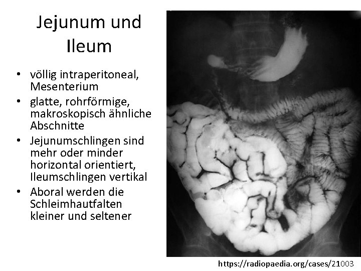 Jejunum und Ileum • völlig intraperitoneal, Mesenterium • glatte, rohrförmige, makroskopisch ähnliche Abschnitte •