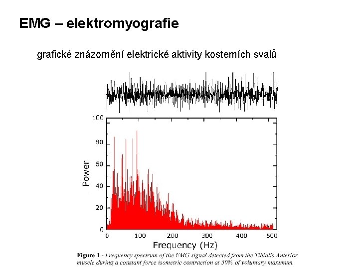 EMG – elektromyografie grafické znázornění elektrické aktivity kosterních svalů 