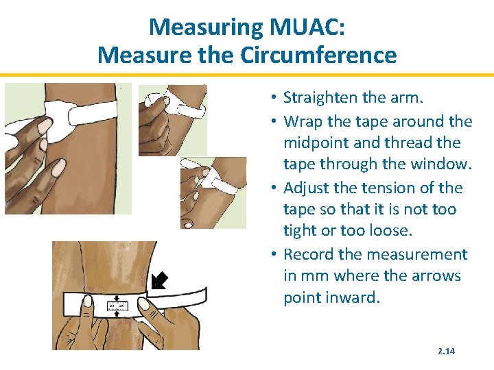 Measuring MUAC: Measure the Circumference • Straighten the arm. • Wrap the tape around