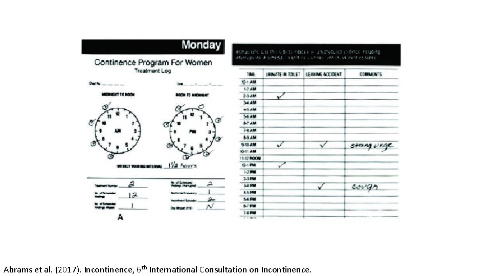 Abrams et al. (2017). Incontinence, 6 th International Consultation on Incontinence. 