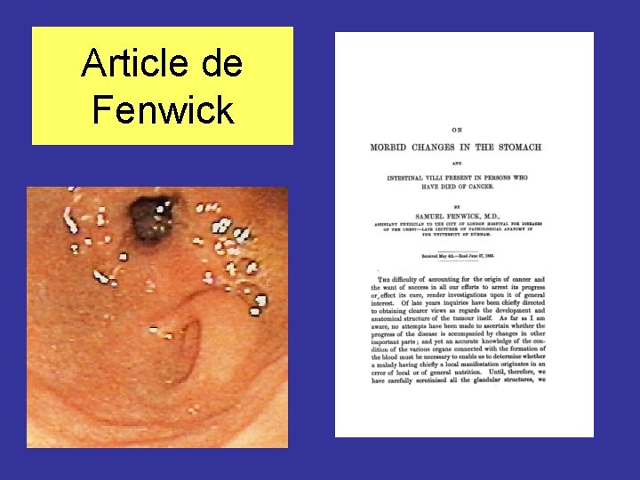 Article de Fenwick 