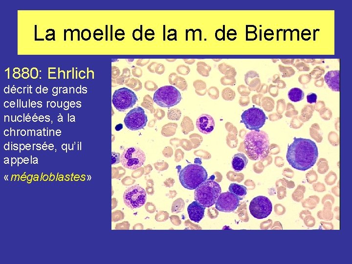 La moelle de la m. de Biermer 1880: Ehrlich décrit de grands cellules rouges