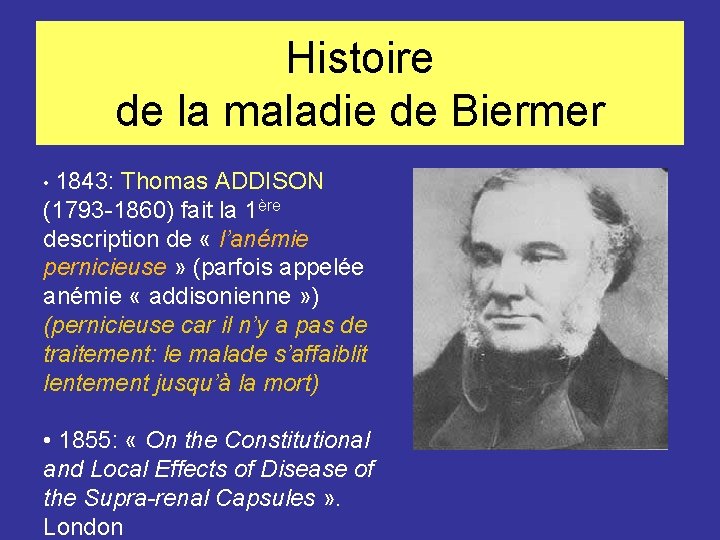 Histoire de la maladie de Biermer • 1843: Thomas ADDISON (1793 -1860) fait la