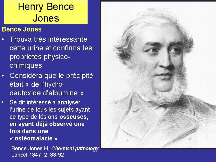 Henry Bence Jones Ben ce Jo n es • Trouva très intéressante cette urine