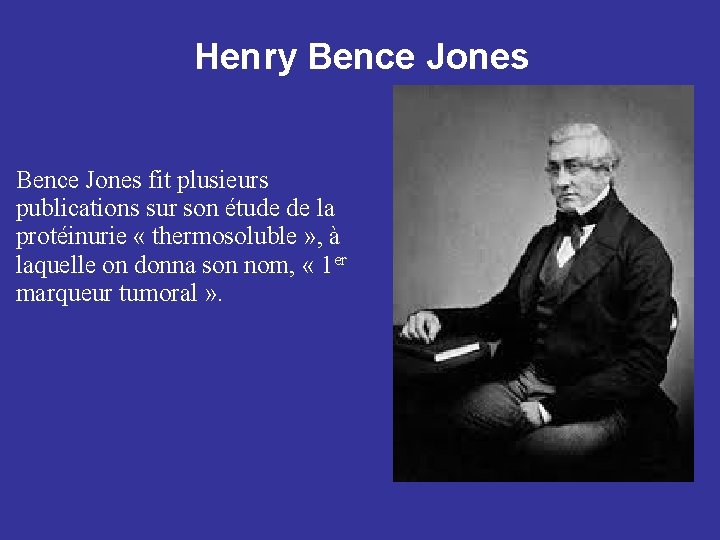 Henry Bence Jones fit plusieurs publications sur son étude de la protéinurie « thermosoluble