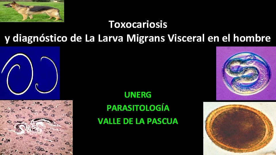 Toxocariosis y diagnóstico de La Larva Migrans Visceral en el hombre UNERG PARASITOLOGÍA VALLE