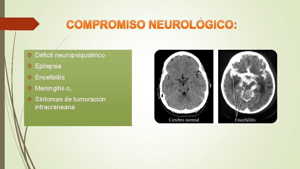 COMPROMISO NEUROLÓGICO: Déficit neuropsiquiátrico Epilepsia Encefalitis Meningitis o, Síntomas de tumoración intracraneana 