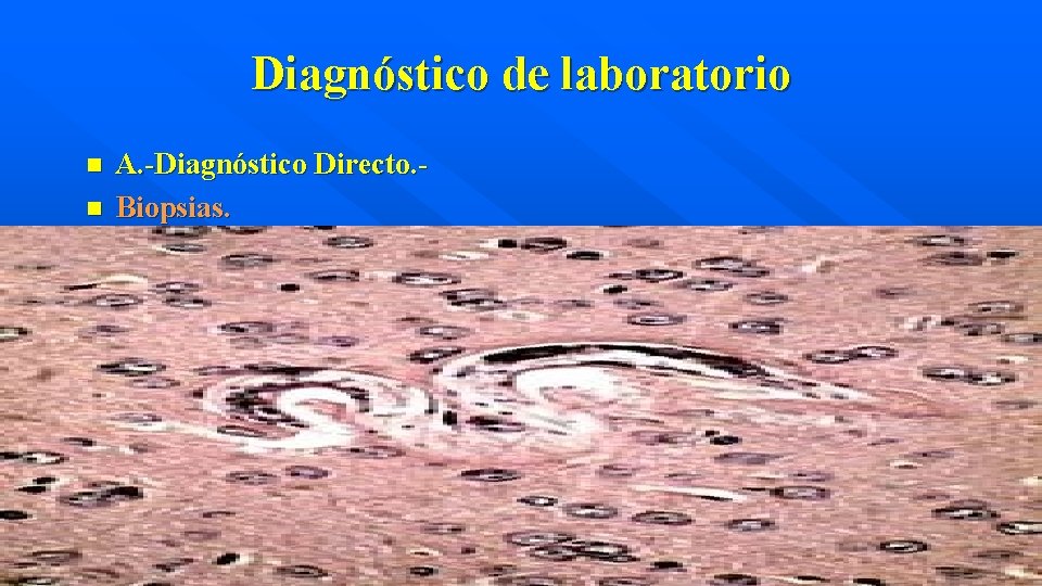 Diagnóstico de laboratorio n n A. -Diagnóstico Directo. Biopsias. 