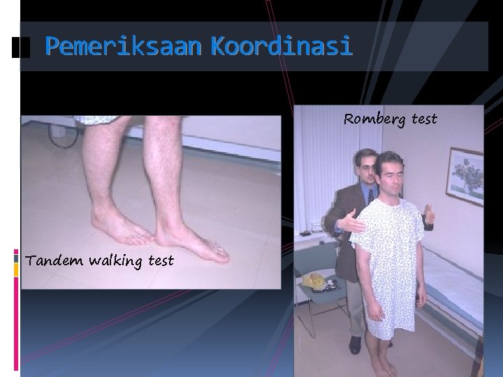 Pemeriksaan Koordinasi Romberg test Tandem walking test 