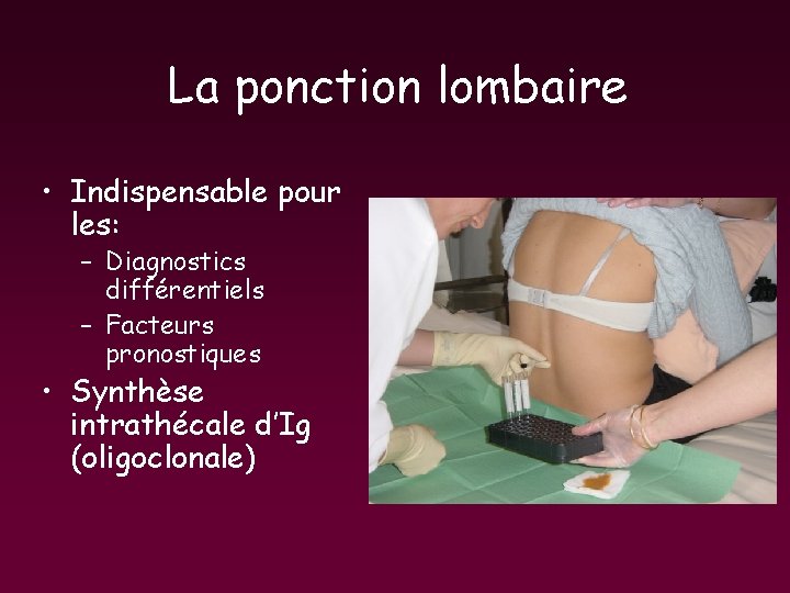 La ponction lombaire • Indispensable pour les: – Diagnostics différentiels – Facteurs pronostiques • La ponction lombaire • Indispensable pour les: – Diagnostics différentiels – Facteurs pronostiques •