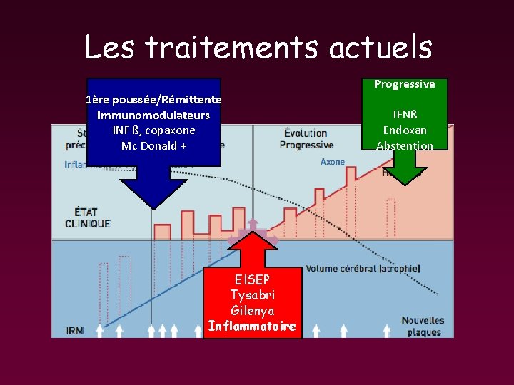 Les traitements actuels Progressive 1ère poussée/Rémittente Immunomodulateurs INF ß, copaxone Mc Donald + El. Les traitements actuels Progressive 1ère poussée/Rémittente Immunomodulateurs INF ß, copaxone Mc Donald + El.