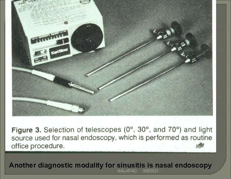 Another diagnostic modality for sinusitis is nasal endoscopy NALAPAD 3/8/2021 Another diagnostic modality for sinusitis is nasal endoscopy NALAPAD 3/8/2021