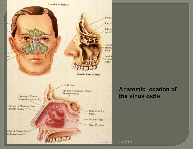 Anatomic location of the sinus ostia NALAPAD 3/8/2021 Anatomic location of the sinus ostia NALAPAD 3/8/2021